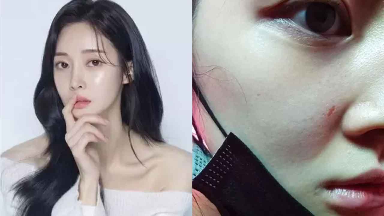 Ex-T-ara Areum Attempted Extreme Choice After Exposing Ex-Husband